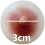 3 cm = 1.18 inches (Small)