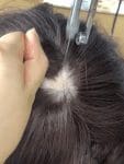 Implanted Hair +$199.00